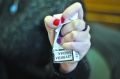 В Югре в этом году более 3 600 курильщиков обратились за медпомощью