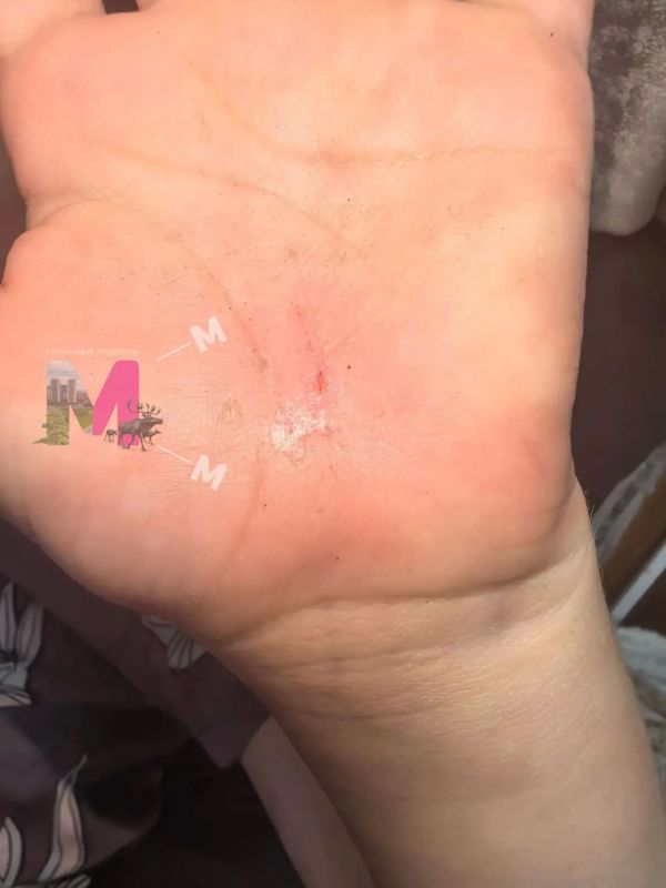 На мою дочь напали 3 собаки, повалили на землю и пытались кусать, одна успела укусить за кисть руки
