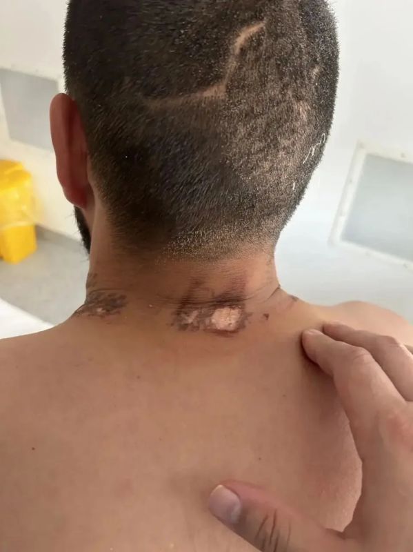 На Алтае молния ударила в бойца во время встречи с медведем На Алтае молния ударила в бойца во время встречи с медведем
