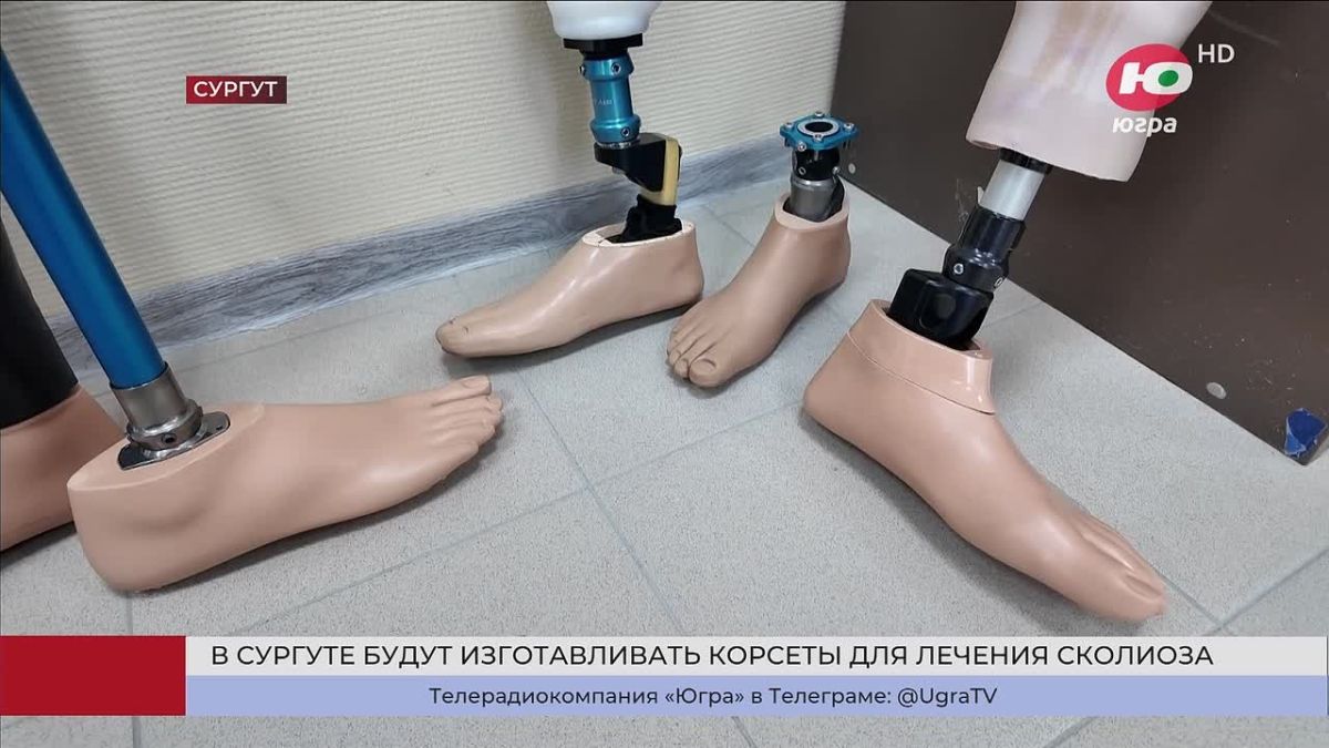 Полный цикл производства корсетов для лечения сколиоза планируют запустить в Сургуте
