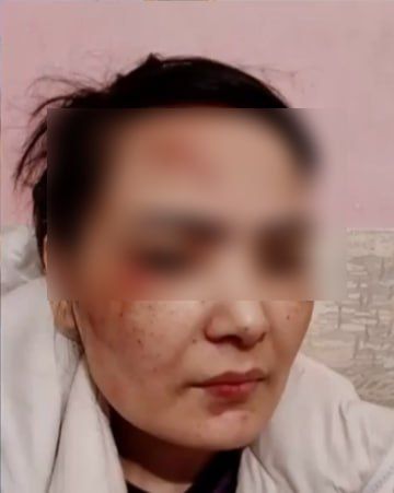 «Карлик из Сургута мучает меня уже 10 лет»: иностранка заявила, что годами терпела унижения со стороны сожителя-лилипута «Карлик из Сургута мучает меня уже 10 лет»: иностранка заявила, что годами терпела унижения со стороны сожителя-лилипута