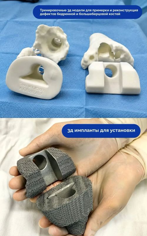 3D-технологии помогли восстановить анатомию коленного сустава пациентки 3D-технологии помогли восстановить анатомию коленного сустава пациентки